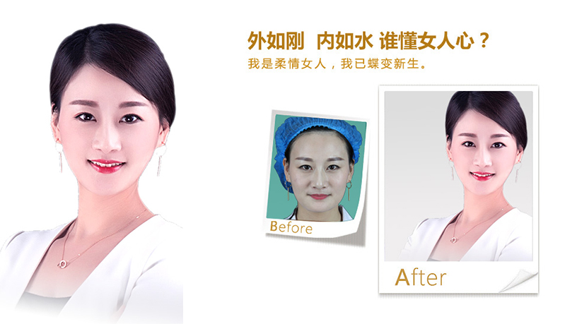 邢台V脸、线雕隆鼻